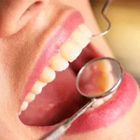 دستیار دندانپزشک