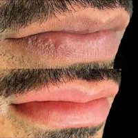 شیدینگ لب و بولدبروزابرو و‌میکرواسکالپ