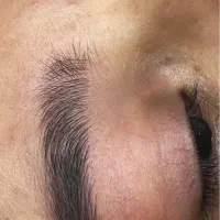 میکرو بلیدینگ ابرو