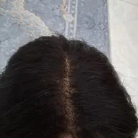 پوستیژ وکلاه گیس موی انسان