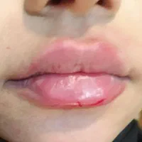 دکتر اکرم آقابیگی پوست مو زیبایی|خدمات آرایشگری و زیبایی|ملایر, |دیوار