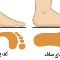 مرکز تخصصی بهبود کف پای صاف