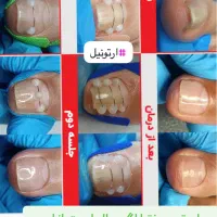 آموزش پدیکور و پارافین تراپی و ارتونیل