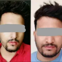 چاقی صورت بدون بازگشت وتضمینی(با جوانه گندم)|آرایشی، بهداشتی، درمانی|جیرفت, |دیوار
