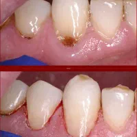 دندانپزشکی بهترین قیمت دانشکده دندانپزشکی گلستان|خدمات آرایشگری و زیبایی|اهواز, گلستان|دیوار
