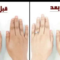 کرم clp سی آی پی مخصوص صورت و دست