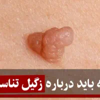 کمک به درمان زگیل تناسلی‌و..|آرایشی، بهداشتی، درمانی|مشهد, کوه سنگی|دیوار