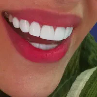 کامپوزیت دندان(جشنواره)