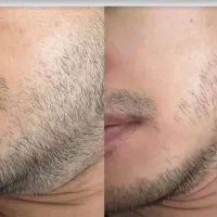 صورتتو با ریش استایل کن مرد