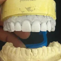 استخدام  پرسلن گذار