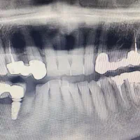 دستیار دندانپزشک