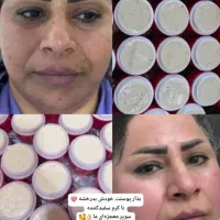 کرم سوپر معجزه اصل|آرایشی، بهداشتی، درمانی|قم, شاه احمد قاسم|دیوار