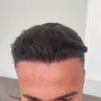 کاشت فول تراکم