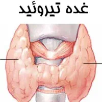 تیروئید