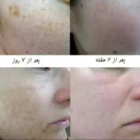 کرم معجزه..شب|آرایشی، بهداشتی، درمانی|بندر ترکمن, |دیوار
