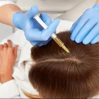 پی ار پی ،کاشت مو ،کاشت ریش