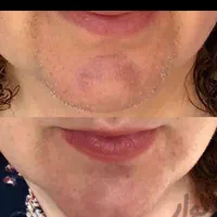 پاک کردن موهای سفید ومشکی