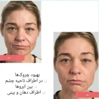 پوستت لایق یه تغییر خاصه|خدمات آرایشگری و زیبایی|شاندیز, |دیوار