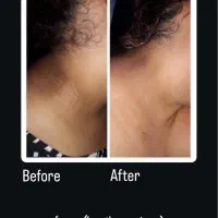 روشن سازی تمام نواحی بدن با قیمت باور نکردنی