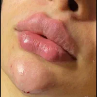 آموزش ژل وبوتاکس|خدمات آرایشگری و زیبایی|اهواز, فاز ۲ پادادشهر|دیوار