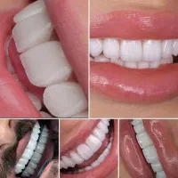 فستیوال اقساطی دندان پزشکی خدمات دندانپزشکی|خدمات آرایشگری و زیبایی|اصفهان, دشتستان|دیوار