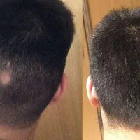 شونه تو مو‌هات می‌کشه کاشت ممنوع