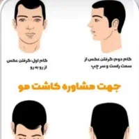 بیا اقساطی مو بکار کاشت مو و ابرو و ریش تضمینی|خدمات آرایشگری و زیبایی|ارومیه, |دیوار