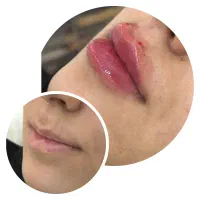 ژل وبوتاکس ،هایفو،پاک کردن تتو، دکتر جابری فر|خدمات آرایشگری و زیبایی|کرمانشاه, |دیوار