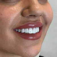 خدمات تخصصی دندانپزشکی در کلینیک نگین شیراز|خدمات آرایشگری و زیبایی|شیراز, زرگری|دیوار