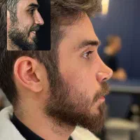 عمل بینی و جراحی لیپوساکشن با تیم پزشکان