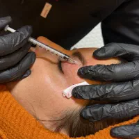 فیلر، بوتاکس، مزوتراپی و خدمات پوست و مو