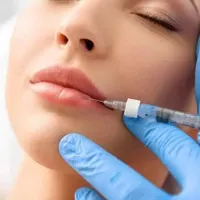 فرصت ویژه برای زیباجویان