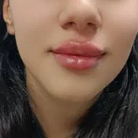 خدمات ژل فقط ۵۸۰ وبوتاکس ۷۵۰ در مطب|خدمات آرایشگری و زیبایی|نجف‌آباد, حومه نجف آباد|دیوار