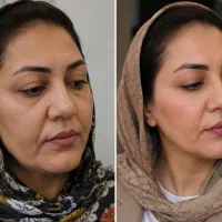 جشنواره فیلر و بوتاکس ۷۹۹