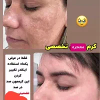 کرم معجزه اصلی|آرایشی، بهداشتی، درمانی|قرچک, شهرک گلها|دیوار