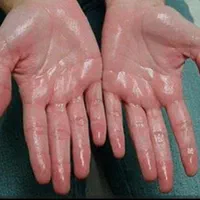 جشنواره بوتاکس اصل مصپورت کل صورت فقط 950|خدمات آرایشگری و زیبایی|نجف‌آباد, شریعتی غربی|دیوار