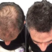 از این استفاده نکنی سرت کلاه رفته