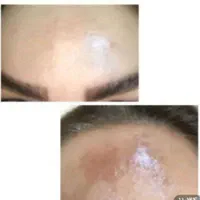 کرم معجزه صد در صد تضمینی با 10سال سابقه کار|آرایشی، بهداشتی، درمانی|خرمشهر, |دیوار
