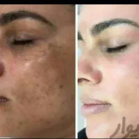 کرم همه کاره معجزه کاملا گیاهی اصل امارات|آرایشی، بهداشتی، درمانی|شیراز, سلطان آباد|دیوار