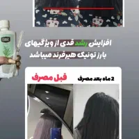 قطع کامل ریزش موباضمانت.تونیک گیاهی هیرفرند|آرایشی، بهداشتی، درمانی|اصفهان, شهرک ولیعصر|دیوار