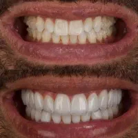 دندانپزشکی یزد|خدمات آرایشگری و زیبایی|رفسنجان, |دیوار