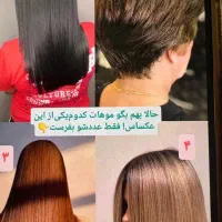 درمان قطعی تخم شپش