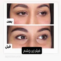 لیزرالکس،الکترولیز،هایفو،کیوسویج،پیرسینگ