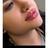 تزریق ژل و بوتاکس فیلر (ولیعصر)