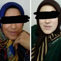 کرم ضد لک و روشن کننده اگوستا