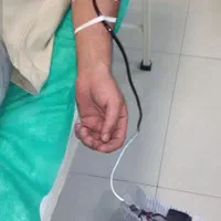شستشو گوش سوراخ کردن گوش فصد خون اجاره دستگاه زردی|خدمات آرایشگری و زیبایی|مشهد, الهیه|دیوار