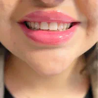 نگین دندان تخصصی