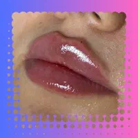 تخفیف ژل لب / مزو / بوتاکس و فیلر|خدمات آرایشگری و زیبایی|مشهد, احمدآباد|دیوار