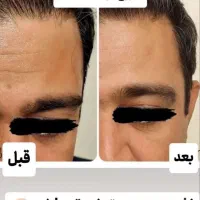 کرم 5 کاره بوتاکس طبیعی|خدمات آرایشگری و زیبایی|گنبد کاووس, |دیوار