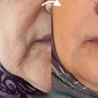 آموزش تخصصی پوست با تخفیف ۵۰ درصدی